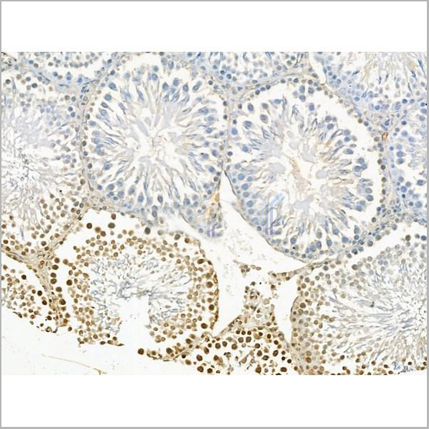 product-image-AAA31190_IHC2.jpg