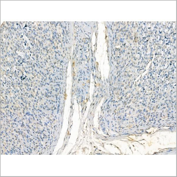 product-image-AAA31190_IHC3.jpg