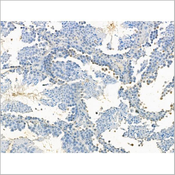 product-image-AAA31190_IHC5.jpg