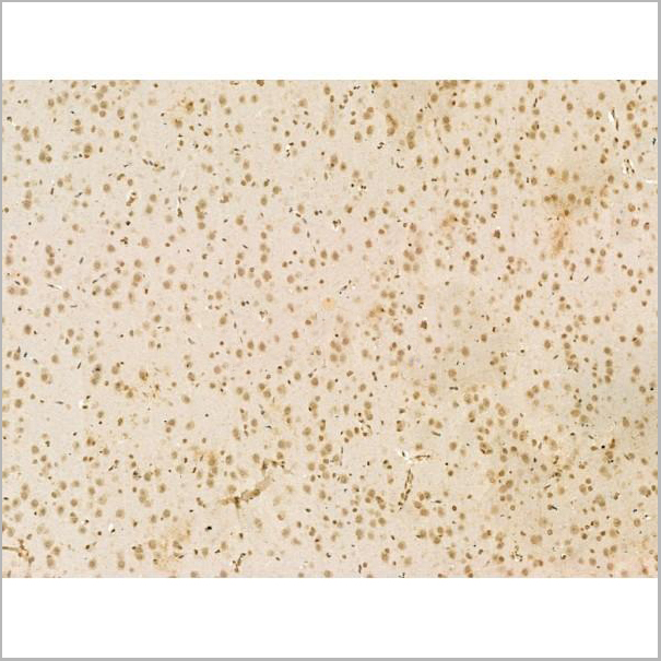 product-image-AAA31191_IHC3.jpg