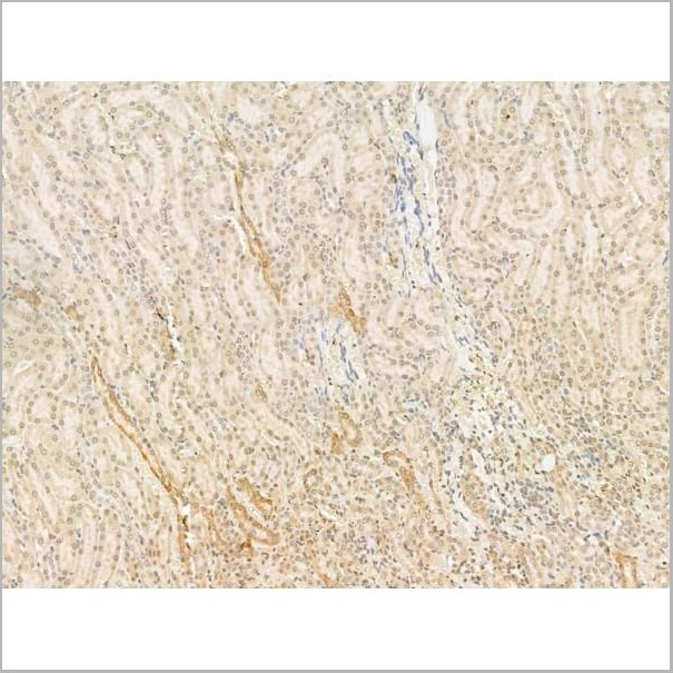 product-image-AAA31191_IHC4.jpg