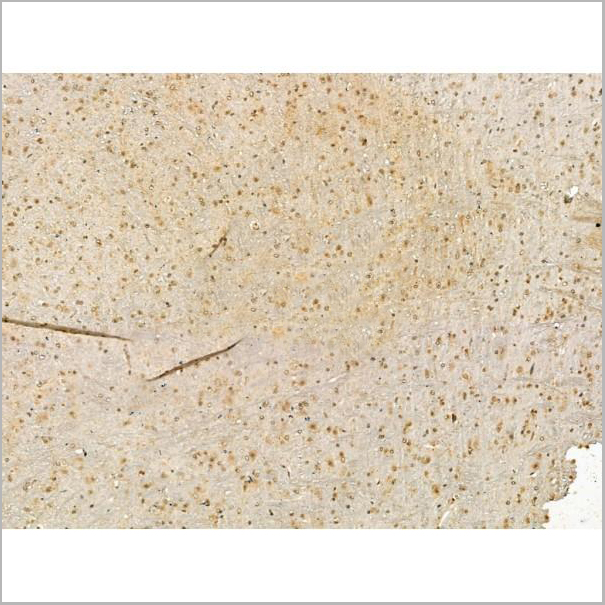 product-image-AAA31191_IHC6.jpg