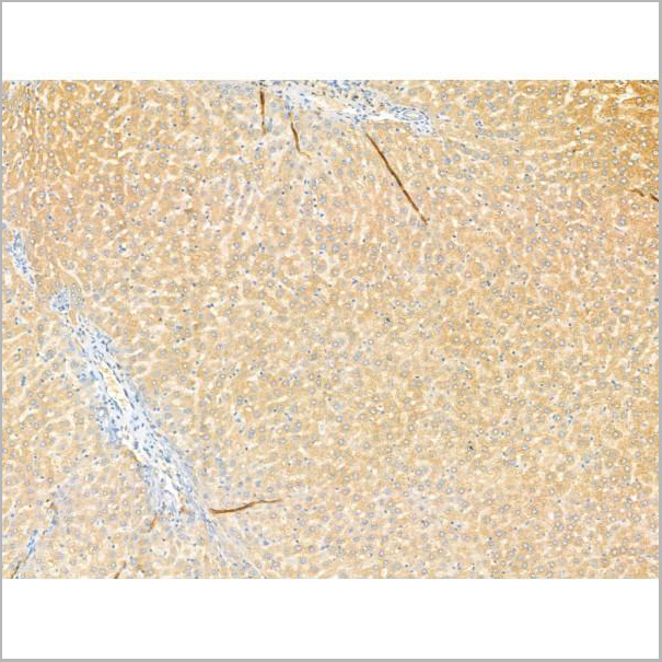product-image-AAA31192_IHC2.jpg