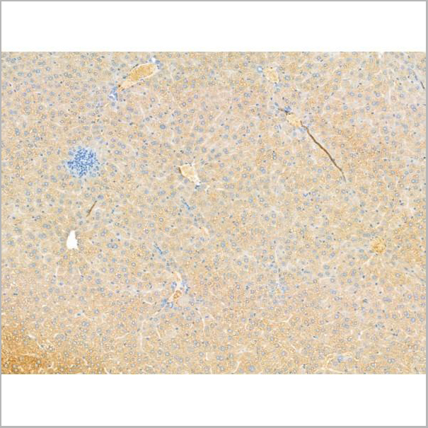 product-image-AAA31192_IHC3.jpg