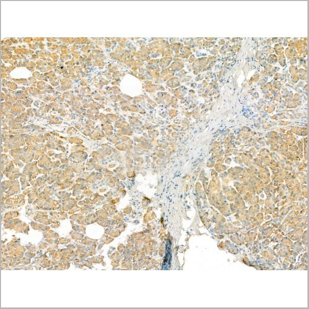 product-image-AAA31192_IHC4.jpg