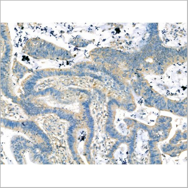 product-image-AAA31192_IHC5.jpg
