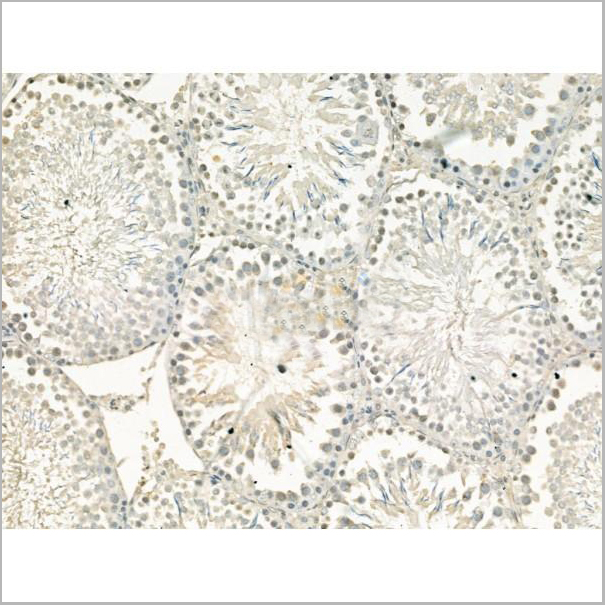 product-image-AAA31193_IHC2.jpg