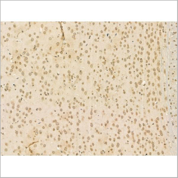 product-image-AAA31193_IHC3.jpg
