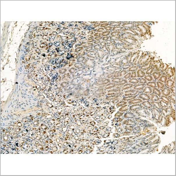product-image-AAA31193_IHC6.jpg