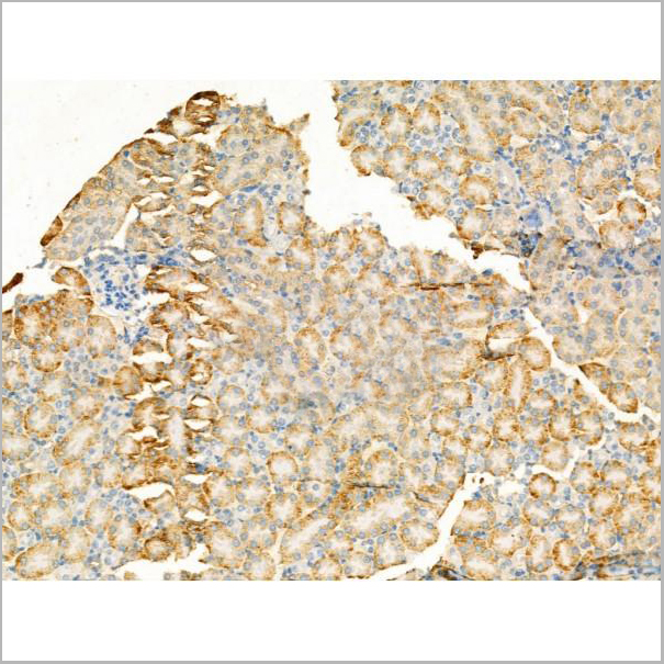 product-image-AAA31194_IHC3.jpg