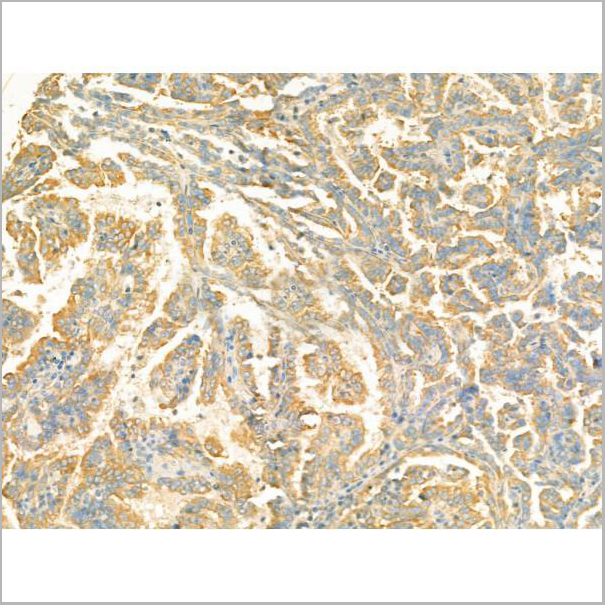 product-image-AAA31194_IHC5.jpg