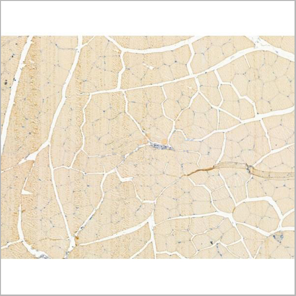 product-image-AAA31195_IHC2.jpg