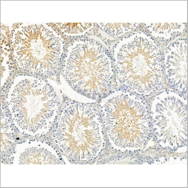 product-image-AAA31195_IHC3.jpg