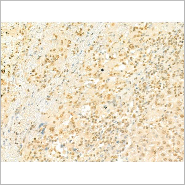 product-image-AAA31196_IHC2.jpg