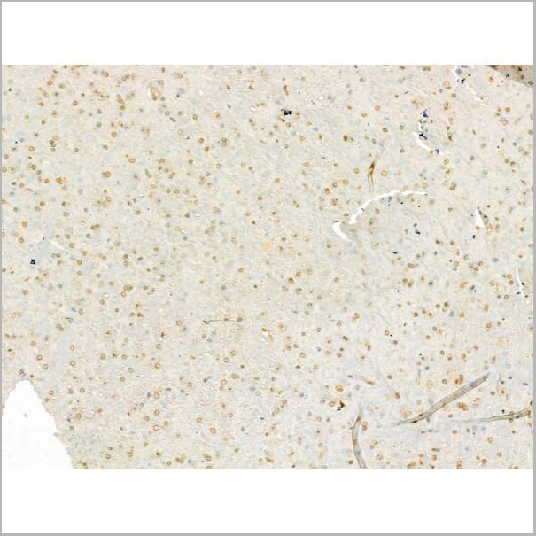 product-image-AAA31196_IHC5.jpg