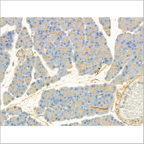 product-image-AAA31197_IHC2.jpg