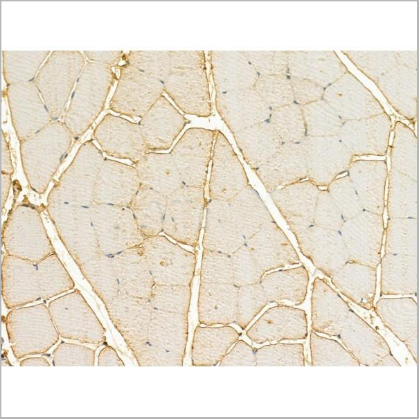 product-image-AAA31197_IHC3.jpg