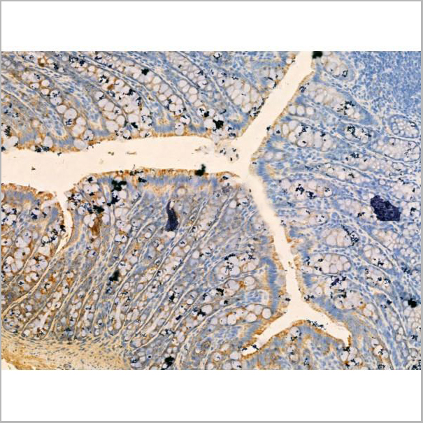 product-image-AAA31198_IHC2.jpg