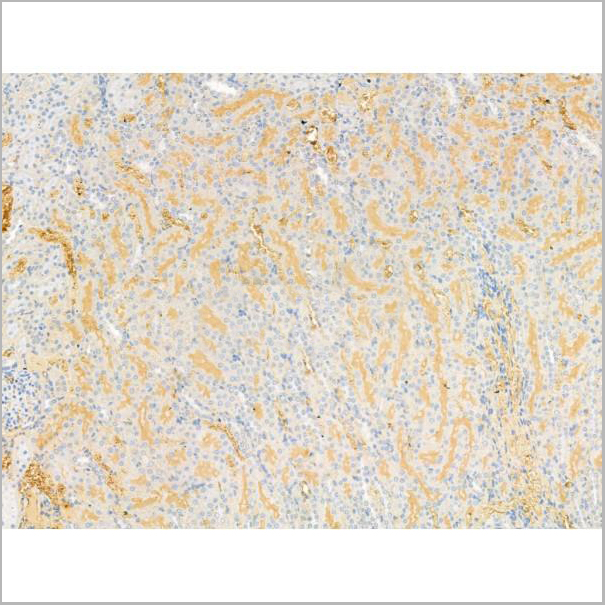 product-image-AAA31199_IHC2.jpg