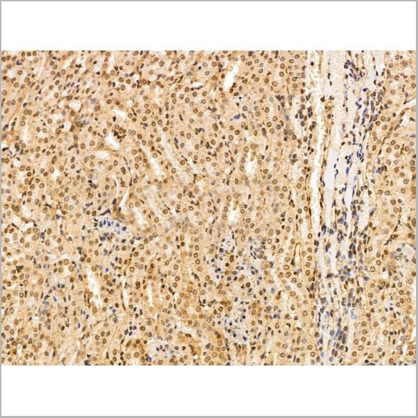 product-image-AAA31200_IHC3.jpg