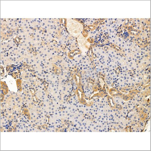 product-image-AAA31200_IHC4.jpg