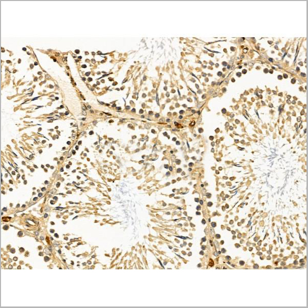 product-image-AAA31201_IHC2.jpg