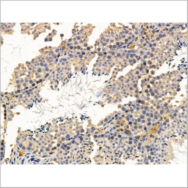 product-image-AAA31201_IHC3.jpg