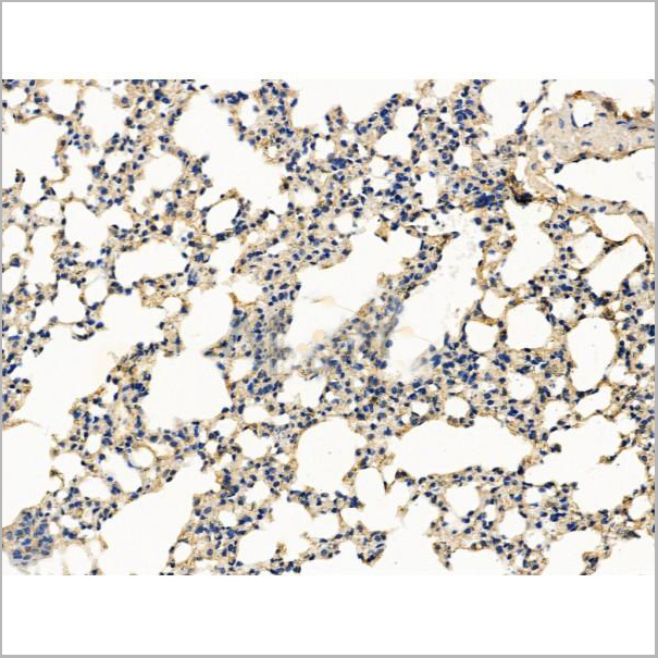 product-image-AAA31201_IHC5.jpg