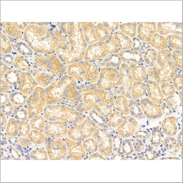 product-image-AAA31201_IHC6.jpg