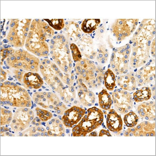 product-image-AAA31202_IHC5.jpg
