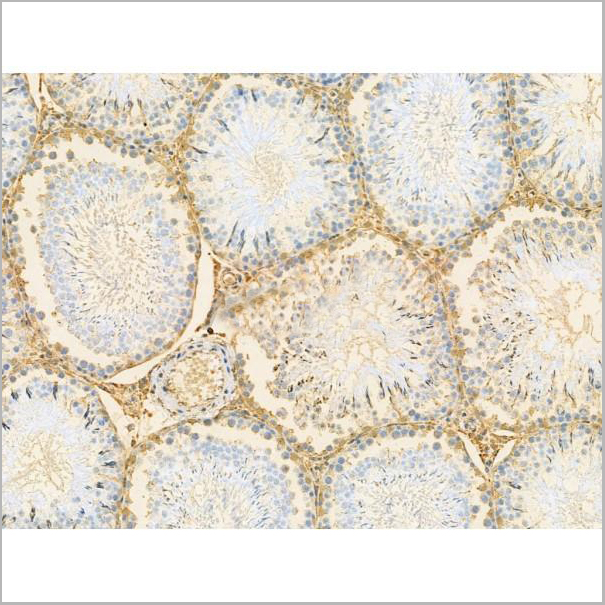 product-image-AAA31203_IHC2.jpg