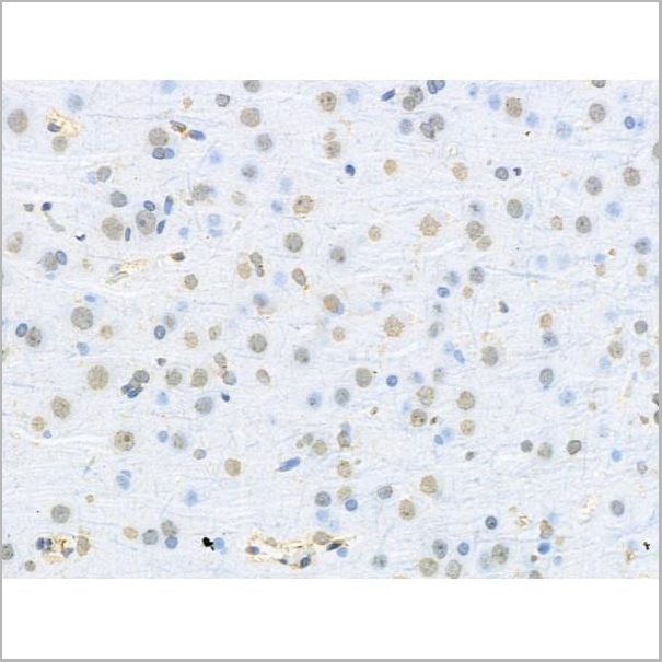 product-image-AAA31203_IHC5.jpg