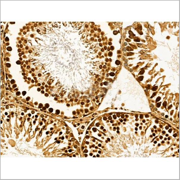 product-image-AAA31204_IHC2.jpg