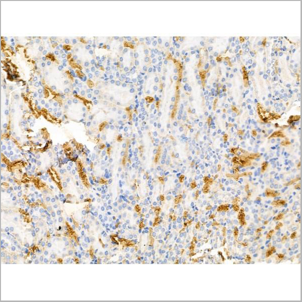 product-image-AAA31204_IHC3.jpg