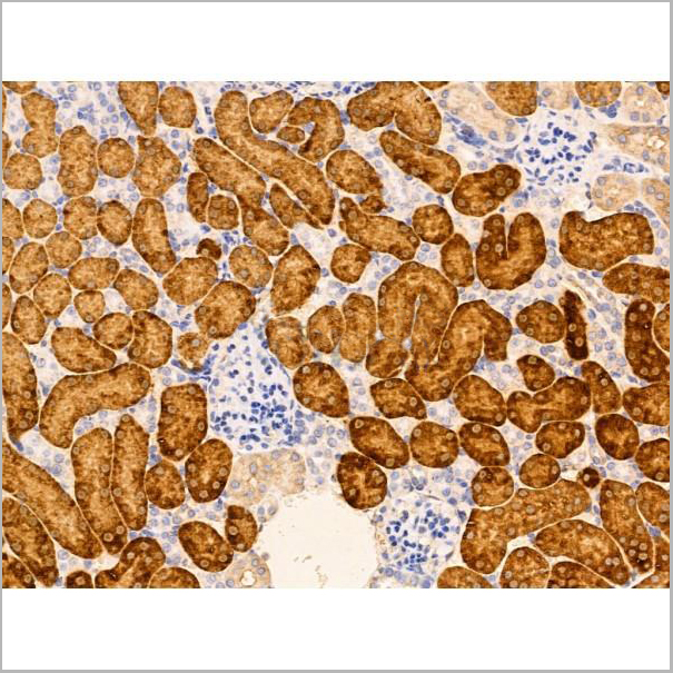 product-image-AAA31204_IHC5.jpg