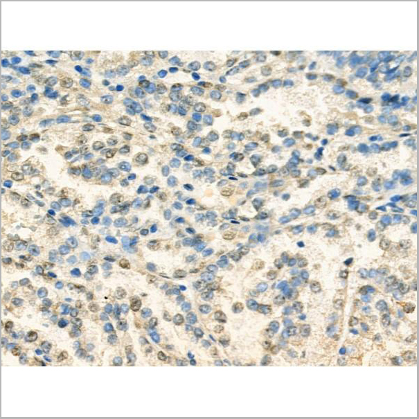 product-image-AAA31205_IHC3.jpg
