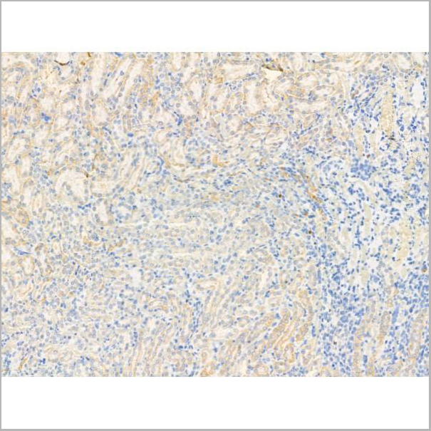 product-image-AAA31206_IHC2.jpg