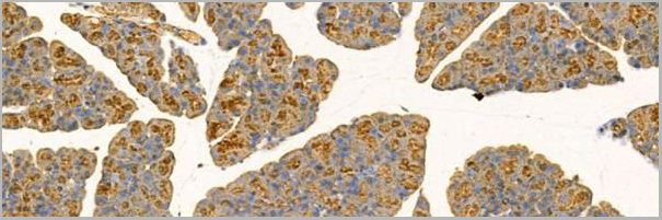 product-image-AAA31207_IHC2.jpg
