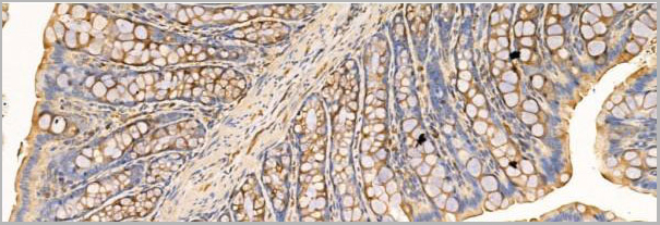 product-image-AAA31207_IHC3.jpg