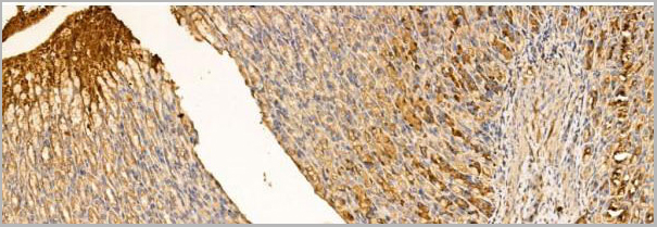 product-image-AAA31207_IHC4.jpg