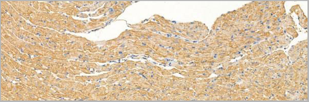product-image-AAA31207_IHC5.jpg
