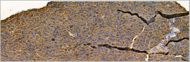 product-image-AAA31207_IHC6.jpg
