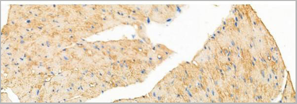 product-image-AAA31207_IHC8.jpg