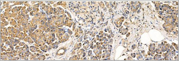 product-image-AAA31207_IHC9.jpg