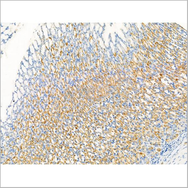 product-image-AAA31208_IHC2.jpg