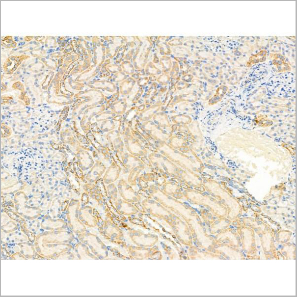 product-image-AAA31208_IHC3.jpg