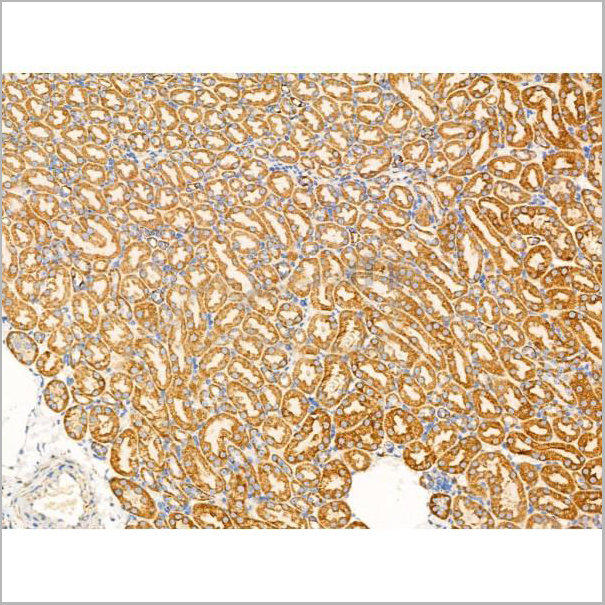product-image-AAA31208_IHC5.jpg