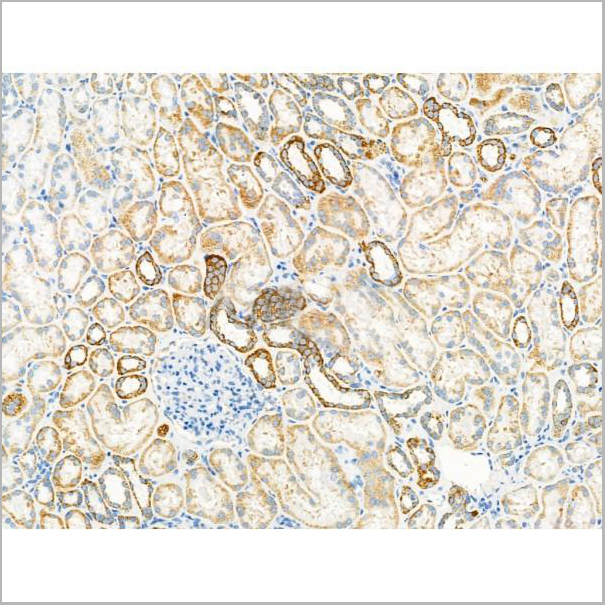 product-image-AAA31208_IHC6.jpg