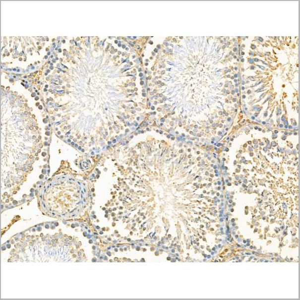 product-image-AAA31209_IHC2.jpg
