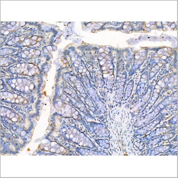 product-image-AAA31209_IHC3.jpg